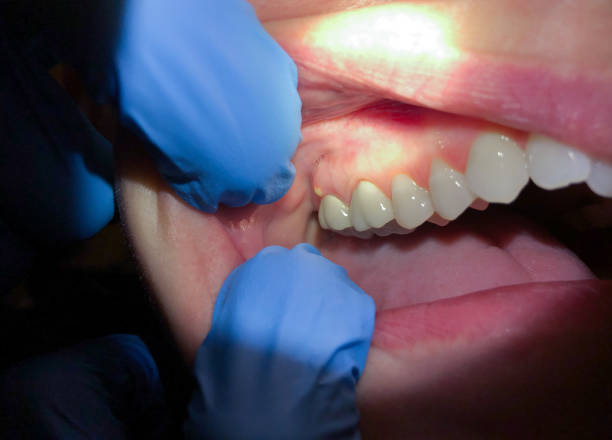 Best Emergency Tooth Extraction  in Norris, TN