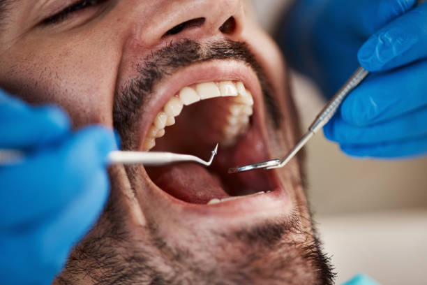 Best Urgent Tooth Repair  in Norris, TN